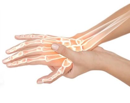 Hondrox é aplicado à área afetada