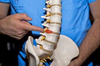 Por que as costas doem na região lombar e o que fazer