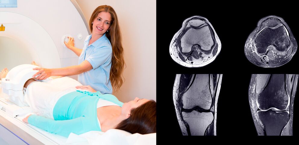 diagnóstico da articulação do joelho