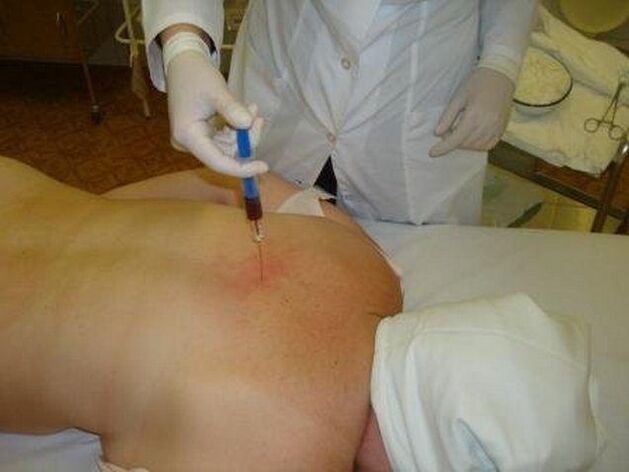 medicamentos para osteocondrose